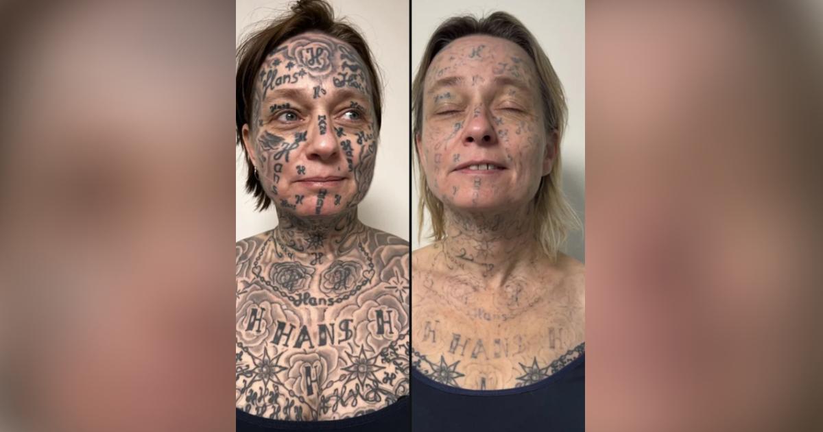 250 Forced Tattoos, One Woman's Fight to Reclaim Her Skin